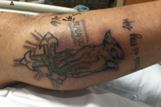 Seorang pria meninggal setelah berenang ketika tato baru dibuat